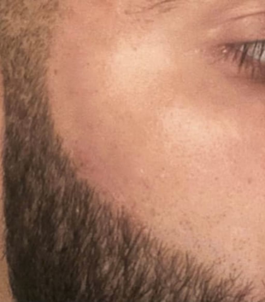 Taalitas IPL Hair Remover