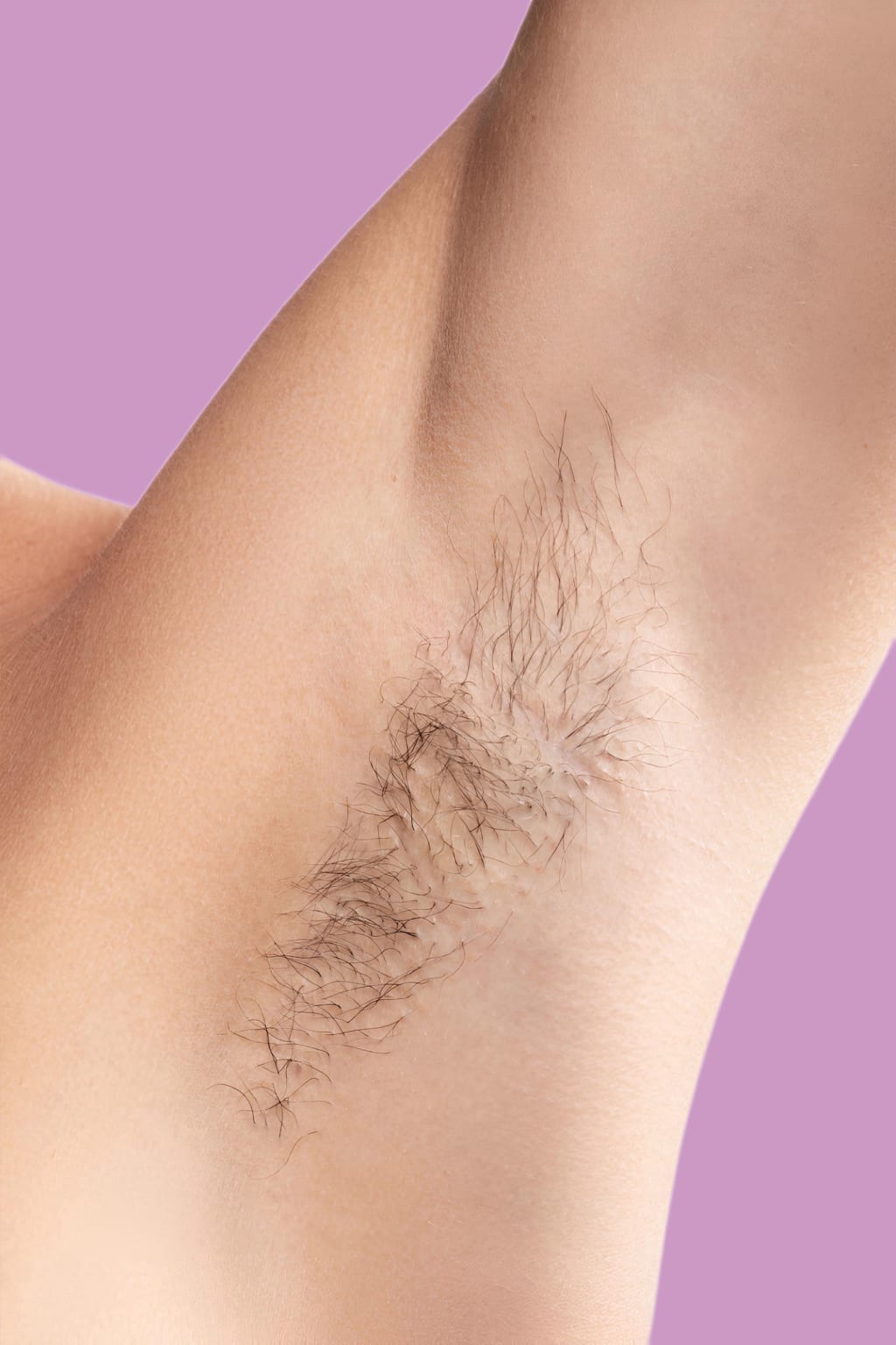 Taalitas IPL Hair Remover