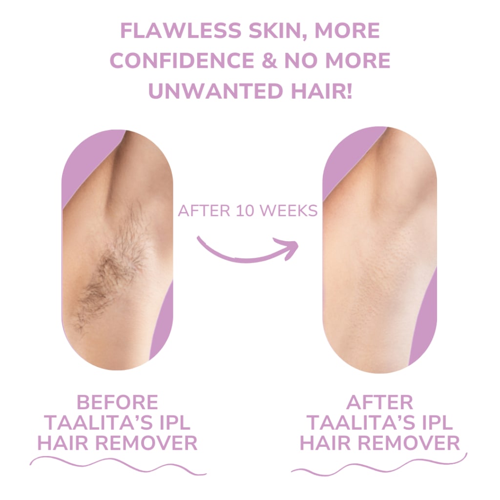 Taalitas IPL Hair Remover
